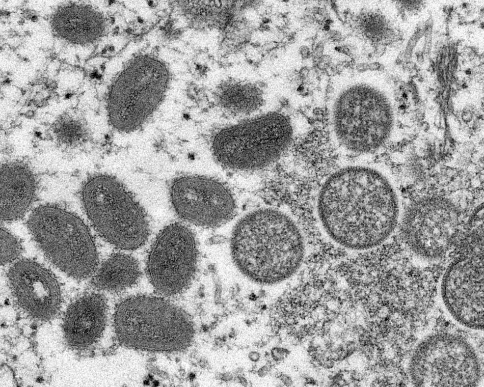 An electron microscope image shows mature, oval-shaped monkeypox virions